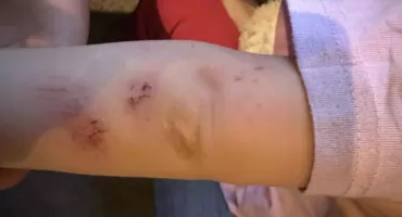 Sokołów Podlaski. Nastolatka na hulajnodze uderzyła w 3-letnią dziewczynkę.